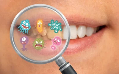 Gum Disease Treatment