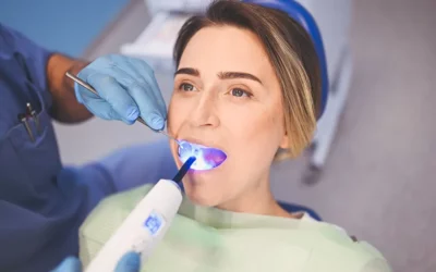 Dental Fillings