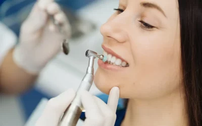 Fluoride Treatments