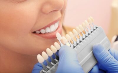 Porcelain Veneers