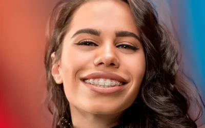 Braces
