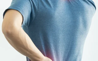 Trigger Point Injections