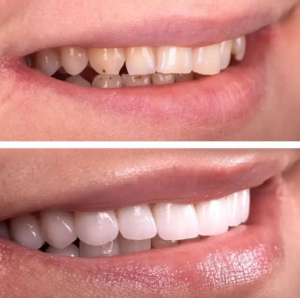 Before and After Before and After